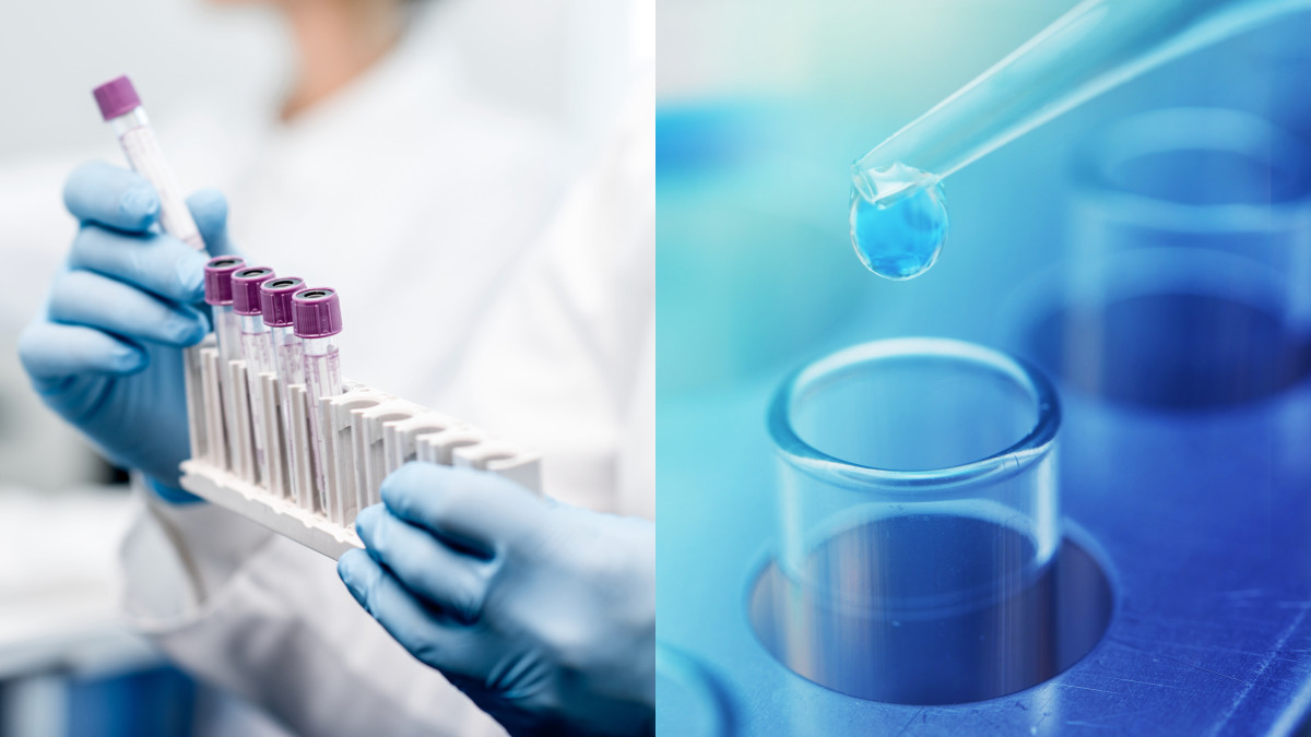 A side by side shot of test tubes in a lab